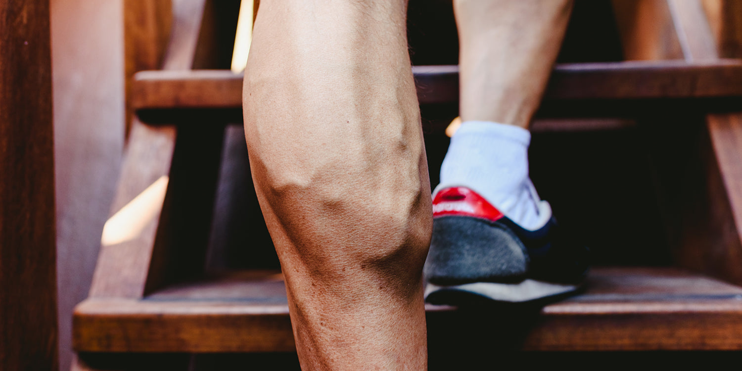 Krampfadern und Fitness – wie wir ihnen vorbeugen können