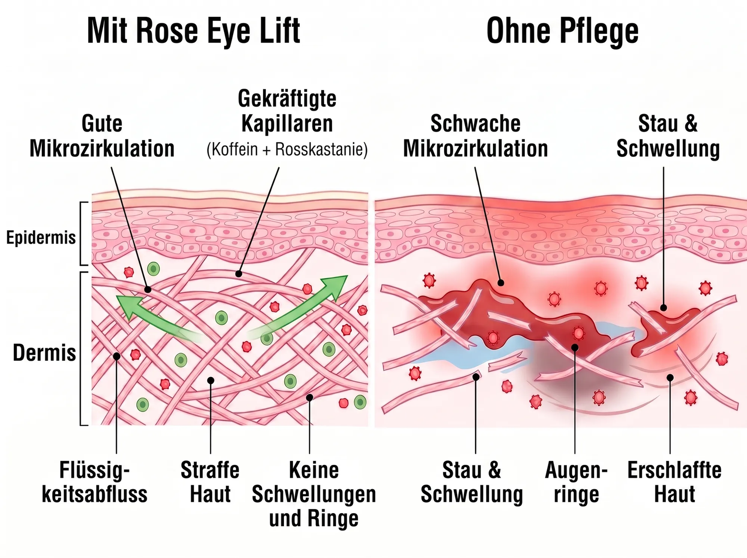 Rose Eye Lift CH t17